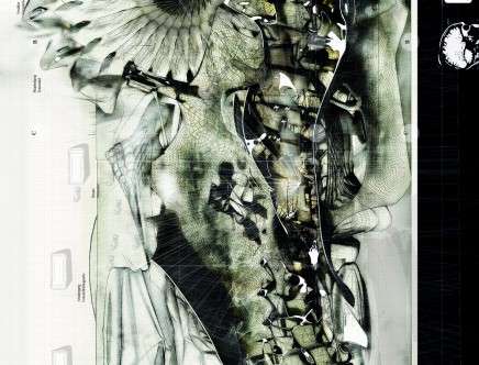 Ferdinand FRITZ, "HFA."